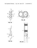 Intravascular Electrode System and Method diagram and image