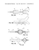 Intravascular Electrode System and Method diagram and image