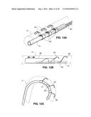 Intravascular Electrode System and Method diagram and image