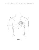 Device and Method for Controlling an Implanted Medical Device diagram and image