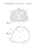 GOLF CLUB HEADS WITH APERTURES AND FILLER MATERIALS diagram and image