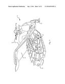 Snowmobile Skid Frame Assembly diagram and image