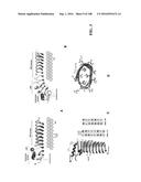 ICE RECRYSTALLISATION INHIBITION PROTEIN OR ANTIFREEZE PROTEINS FROM     DESCHAMPSIA, AND FESTUCA SPECIES OF GRASS diagram and image