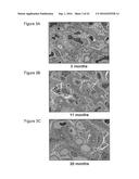 ASSESSING RENAL STRUCTURAL ALTERATIONS AND OUTCOMES diagram and image