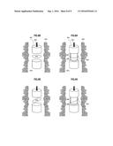 SHIELDING DEVICE FOR IMPROVING DYNAMIC RANGE OF ELECTROMAGNETIC     MEASUREMENTS diagram and image