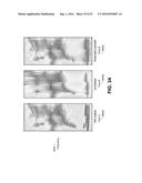 SYSTEMS AND METHODS FOR SPEECH RESTORATION diagram and image