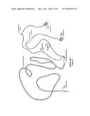 CYLINDRICAL FOLDING CABLE diagram and image