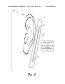 Utilization of Antenna Loading for Impedance Matching diagram and image