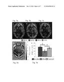 Off-resonance correction for pseudo-continuous arterial spin labeling diagram and image