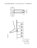 Calibrated Systems, Devices and Methods for Preventing, Detecting, and     Treating Pressure-Induced Ischemia, Pressure Ulcers, and Other Conditions diagram and image