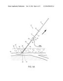 APPARATUS AND METHODS FOR SEALING A VASCULAR PUNCTURE diagram and image