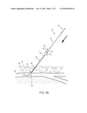 APPARATUS AND METHODS FOR SEALING A VASCULAR PUNCTURE diagram and image