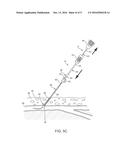 APPARATUS AND METHODS FOR SEALING A VASCULAR PUNCTURE diagram and image