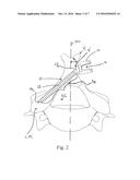 METHOD AND SYSTEM FOR TRANS-LAMINA SPINAL FIXATION diagram and image