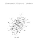 METHOD AND SYSTEM FOR TRANS-LAMINA SPINAL FIXATION diagram and image