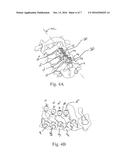 METHOD AND SYSTEM FOR TRANS-LAMINA SPINAL FIXATION diagram and image