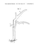 TETHER TENSIONING INSTRUMENT diagram and image