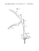 TETHER TENSIONING INSTRUMENT diagram and image