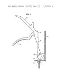 TETHER TENSIONING INSTRUMENT diagram and image