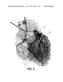 SYSTEM AND METHOD FOR VASCULAR TREE GENERATION USING PATIENT-SPECIFIC     STRUCTURAL AND FUNCTIONAL DATA, AND JOINT PRIOR INFORMATION diagram and image