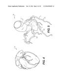 IMAGE PROCESSING AND PATIENT-SPECIFIC MODELING OF BLOOD FLOW diagram and image