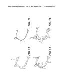 IMAGE PROCESSING AND PATIENT-SPECIFIC MODELING OF BLOOD FLOW diagram and image