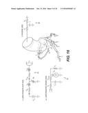 IMAGE PROCESSING AND PATIENT-SPECIFIC MODELING OF BLOOD FLOW diagram and image