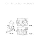 IMAGE PROCESSING AND PATIENT-SPECIFIC MODELING OF BLOOD FLOW diagram and image