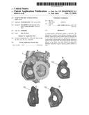 PATIENT-SPECIFIC INTRALUMINAL IMPLANTS diagram and image