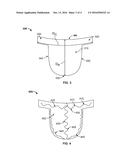 SYNTHETIC HEART VALVES COMPOSED OF ZWITTERIONIC POLYMERS diagram and image