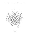 MEDICAL DEVICE FOR TREATING A HEART VALVE INSUFFICENCY diagram and image