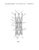 MEDICAL DEVICE FOR TREATING A HEART VALVE INSUFFICENCY diagram and image