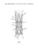 MEDICAL DEVICE FOR TREATING A HEART VALVE INSUFFICENCY diagram and image