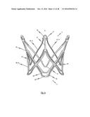 MEDICAL DEVICE FOR TREATING A HEART VALVE INSUFFICENCY diagram and image