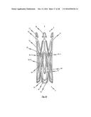 MEDICAL DEVICE FOR TREATING A HEART VALVE INSUFFICENCY diagram and image