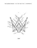 MEDICAL DEVICE FOR TREATING A HEART VALVE INSUFFICENCY diagram and image