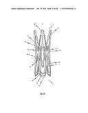 MEDICAL DEVICE FOR TREATING A HEART VALVE INSUFFICENCY diagram and image