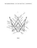 MEDICAL DEVICE FOR TREATING A HEART VALVE INSUFFICENCY diagram and image