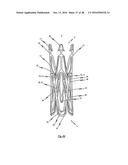 MEDICAL DEVICE FOR TREATING A HEART VALVE INSUFFICENCY diagram and image