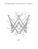 MEDICAL DEVICE FOR TREATING A HEART VALVE INSUFFICENCY diagram and image