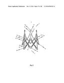 MEDICAL DEVICE FOR TREATING A HEART VALVE INSUFFICENCY diagram and image