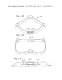 SURGICAL HEART VALVES ADAPTED FOR POST IMPLANT EXPANSION diagram and image