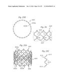 SURGICAL HEART VALVES ADAPTED FOR POST IMPLANT EXPANSION diagram and image