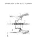 SURGICAL HEART VALVES ADAPTED FOR POST IMPLANT EXPANSION diagram and image