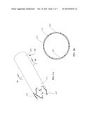 ELECTROSPUN PTFE ENCAPSULATED STENT AND METHOD OF MANUFACTURE diagram and image