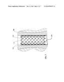 ELECTROSPUN PTFE ENCAPSULATED STENT AND METHOD OF MANUFACTURE diagram and image