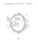 SYSTEM AND PROCESS FOR RETINA PHOTOTHERAPY diagram and image