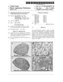 METHOD FOR TREATING PANCREATITIS WITH MESENCHYMAL STEM CELLS diagram and image