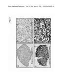 METHOD FOR TREATING PANCREATITIS WITH MESENCHYMAL STEM CELLS diagram and image