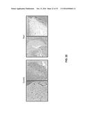 Peptide Having Angiogenesis Inhibitory Activity and Composition Containing     Same diagram and image